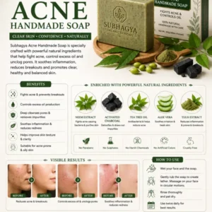 Acne Handmade Soap (current product image)